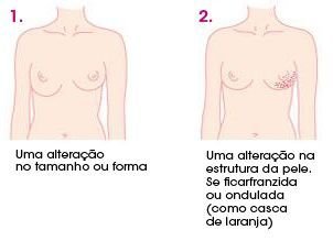 Estar em alerta é o 1º passo na prevenção